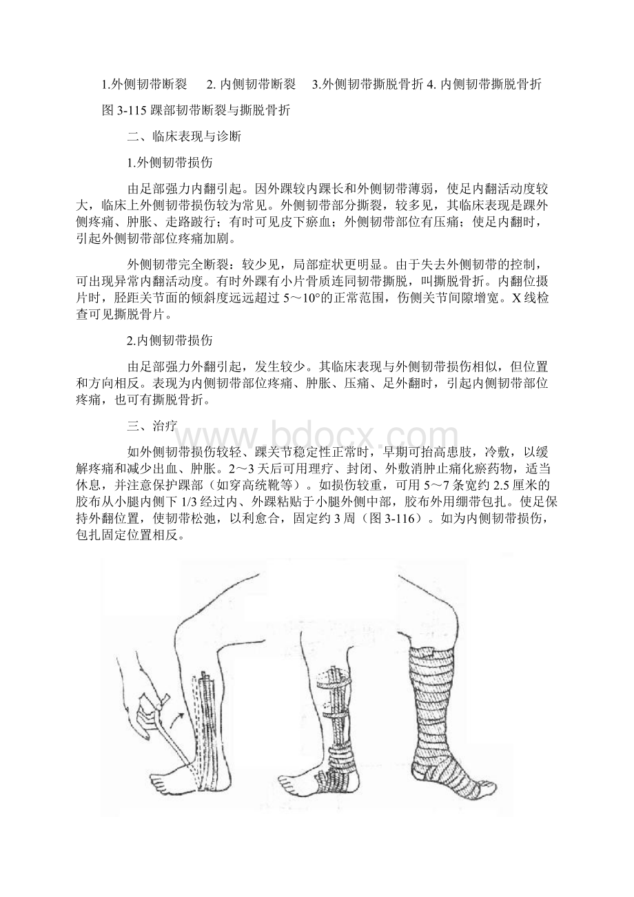 第六章 关节损伤讲解.docx_第3页