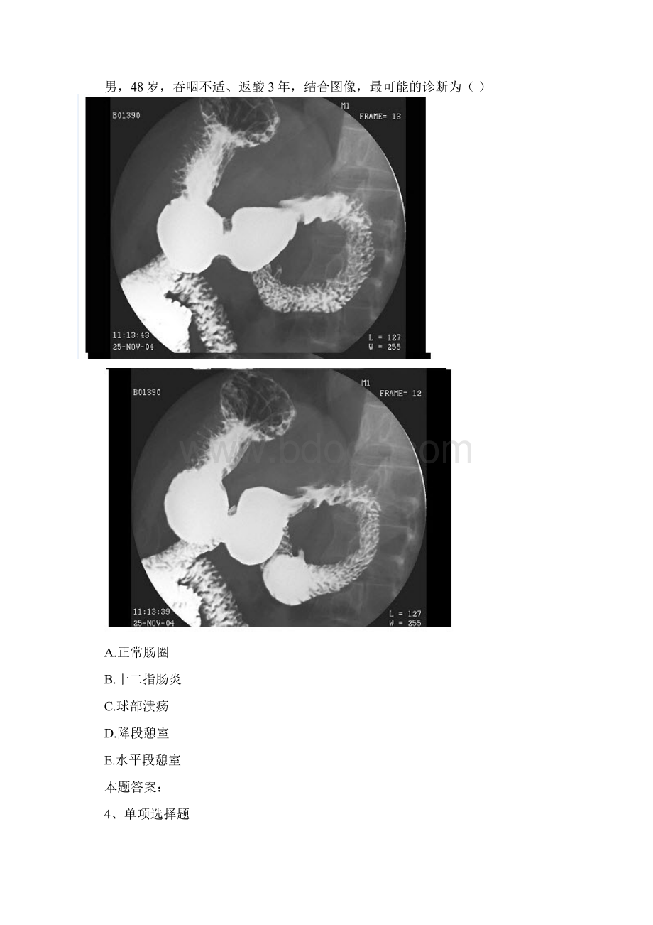 放射医学医学高级X线考试考试题最新版3docWord文件下载.docx_第2页