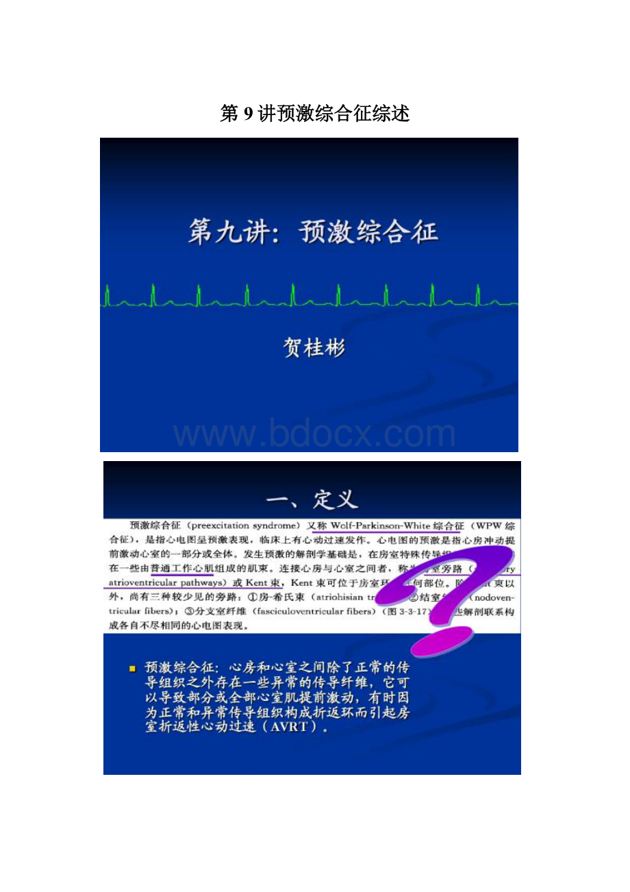 第9讲预激综合征综述Word文档格式.docx