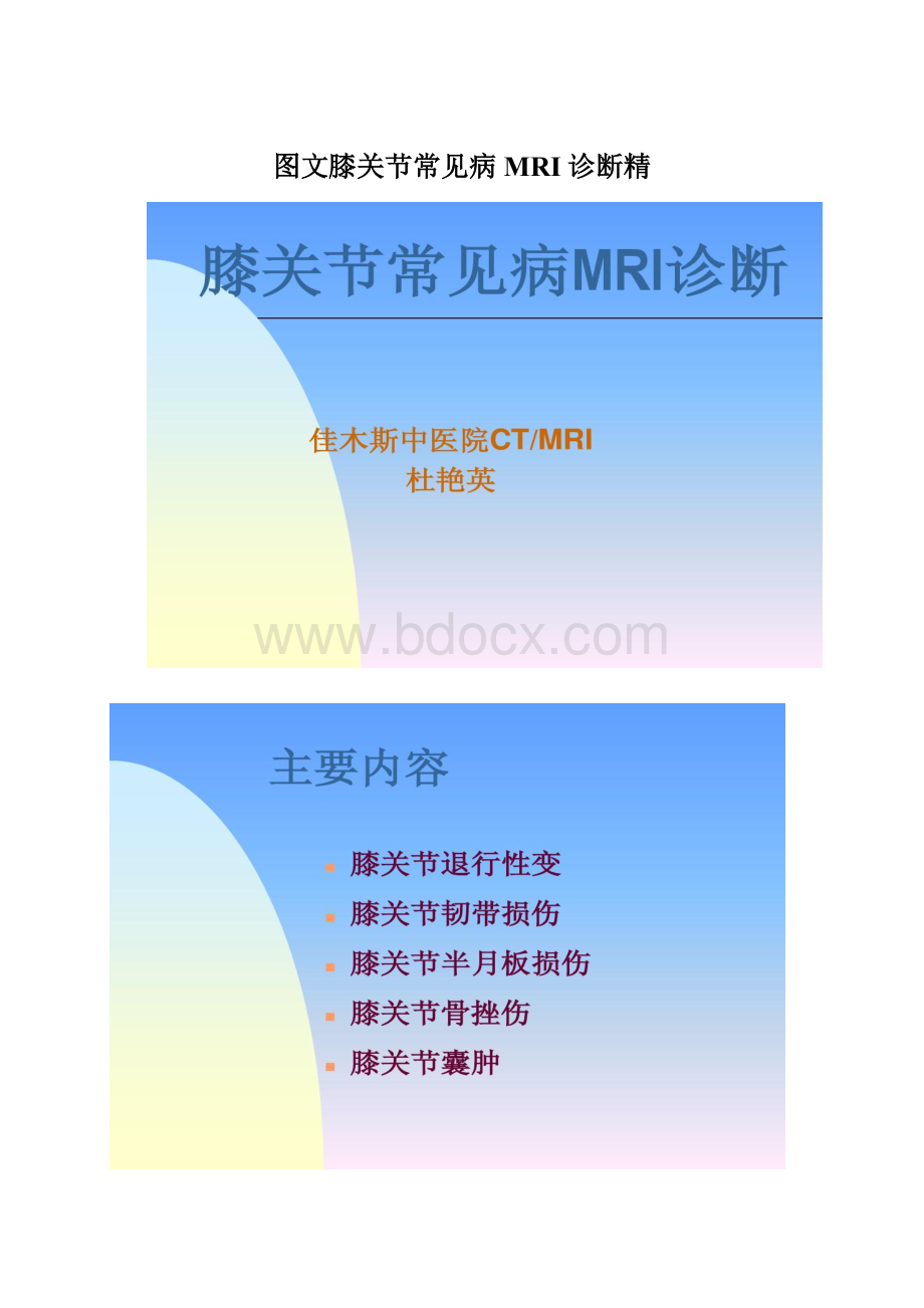 图文膝关节常见病MRI诊断精Word文档下载推荐.docx