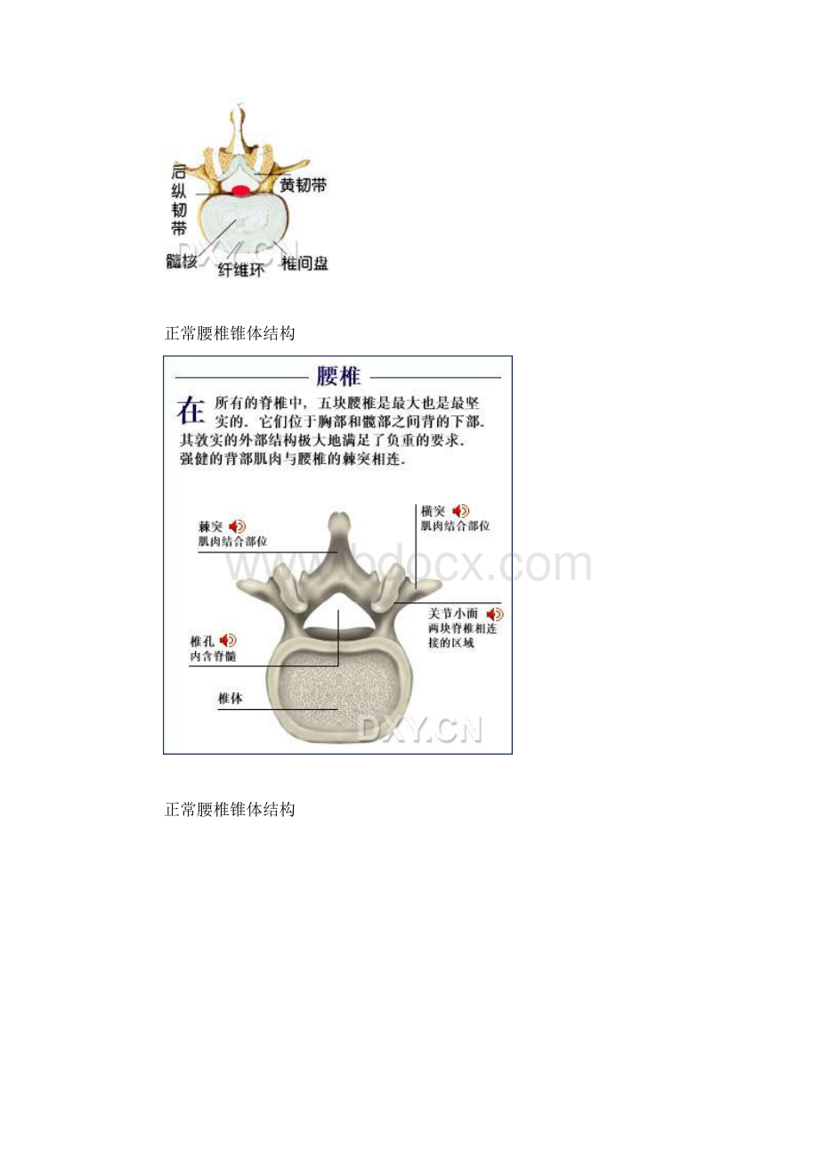 椎间盘突出症详解Word格式.docx_第3页