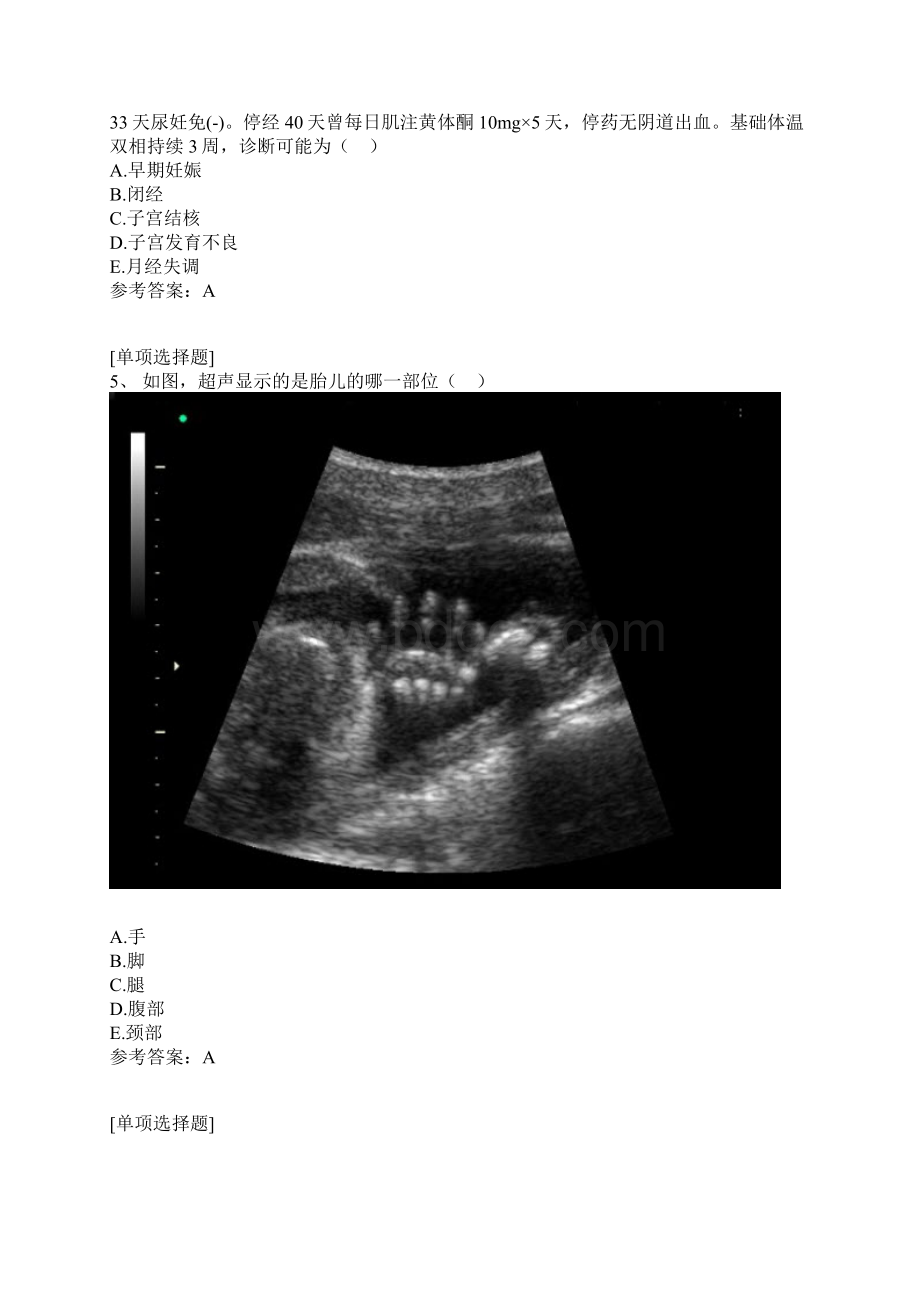 妊娠诊断Word文档下载推荐.docx_第2页