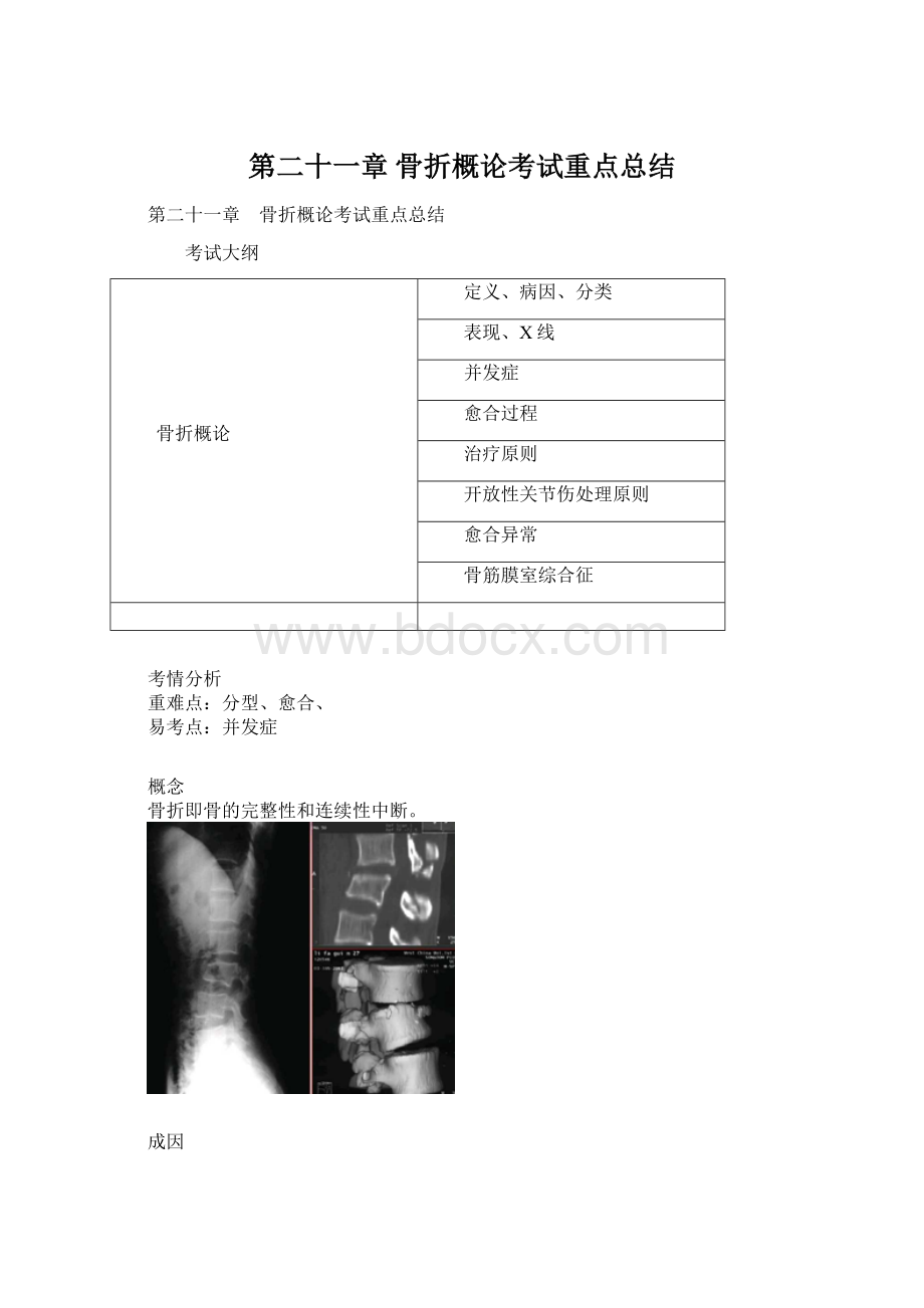 第二十一章 骨折概论考试重点总结.docx_第1页