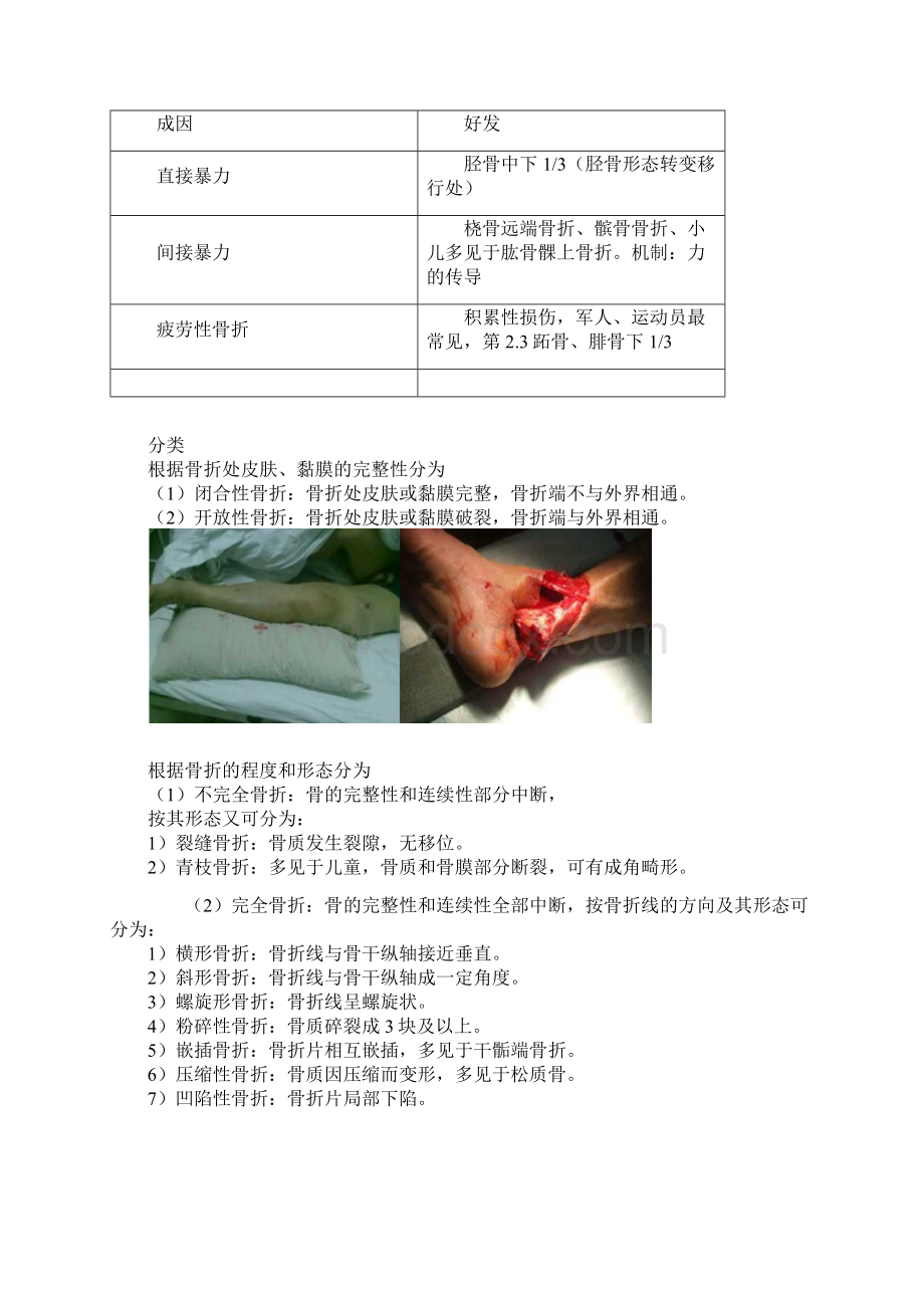 第二十一章 骨折概论考试重点总结.docx_第2页