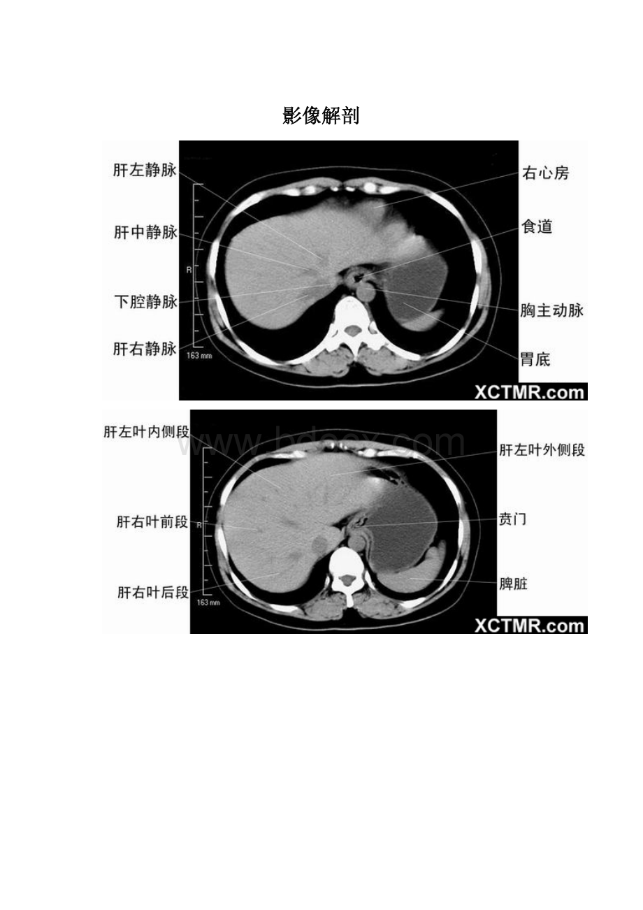 影像解剖.docx