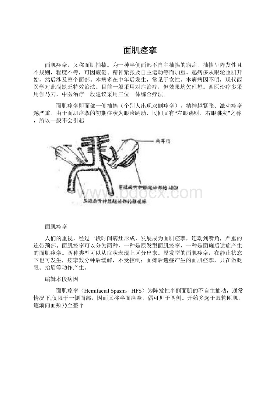 面肌痉挛.docx_第1页