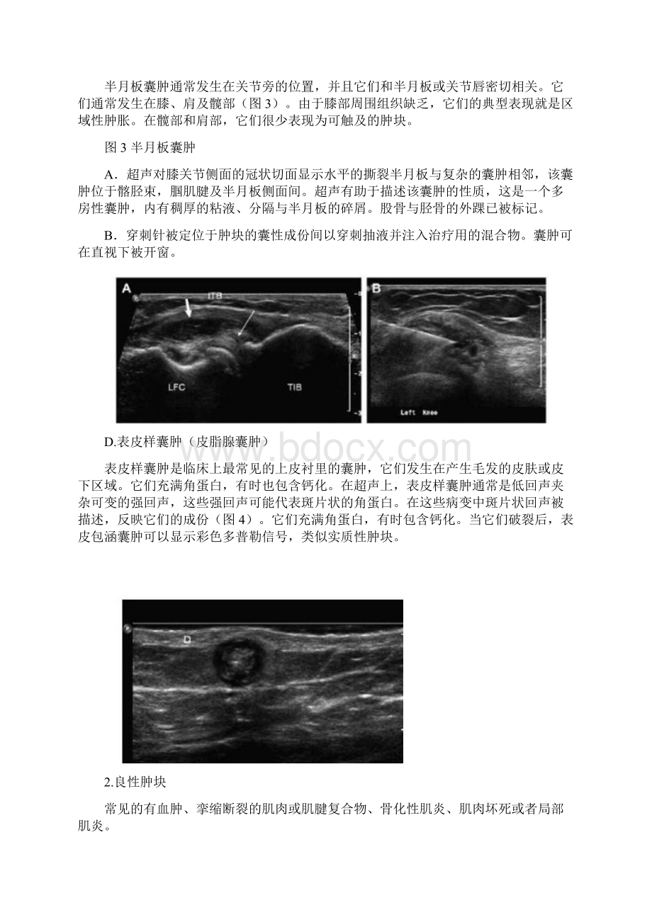 classica肌肉骨骼软组织肿块的超声评价.docx_第3页