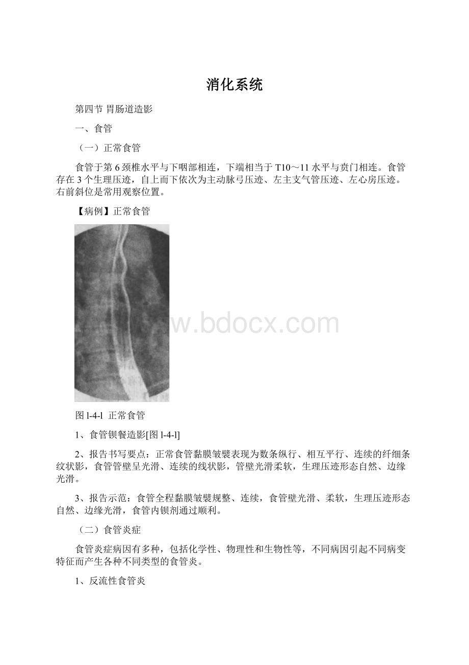 消化系统Word文档格式.docx