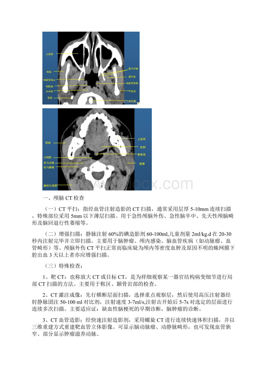 CT读片指南.docx_第2页