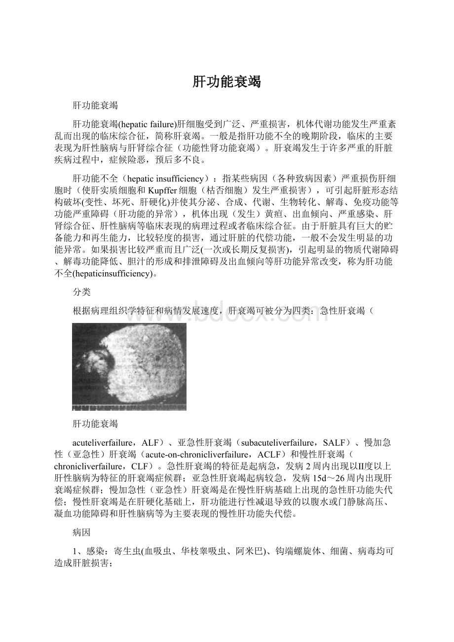 肝功能衰竭Word文档格式.docx_第1页