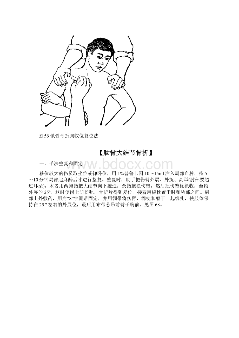 骨折手法整复方法.docx_第2页