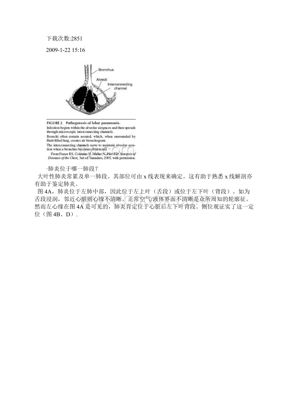 《急诊影像学》.docx_第3页