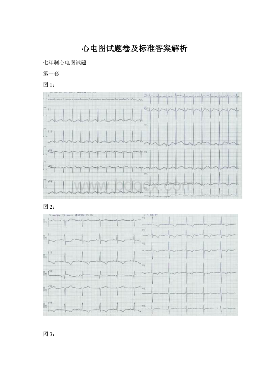 心电图试题卷及标准答案解析.docx_第1页
