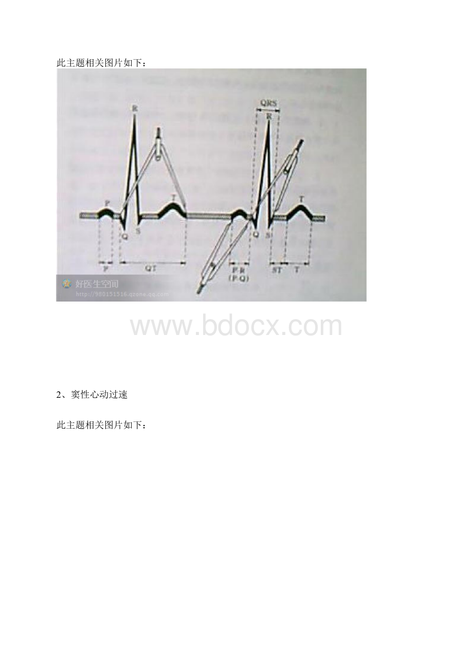 心电图的记忆方法收藏着.docx_第2页