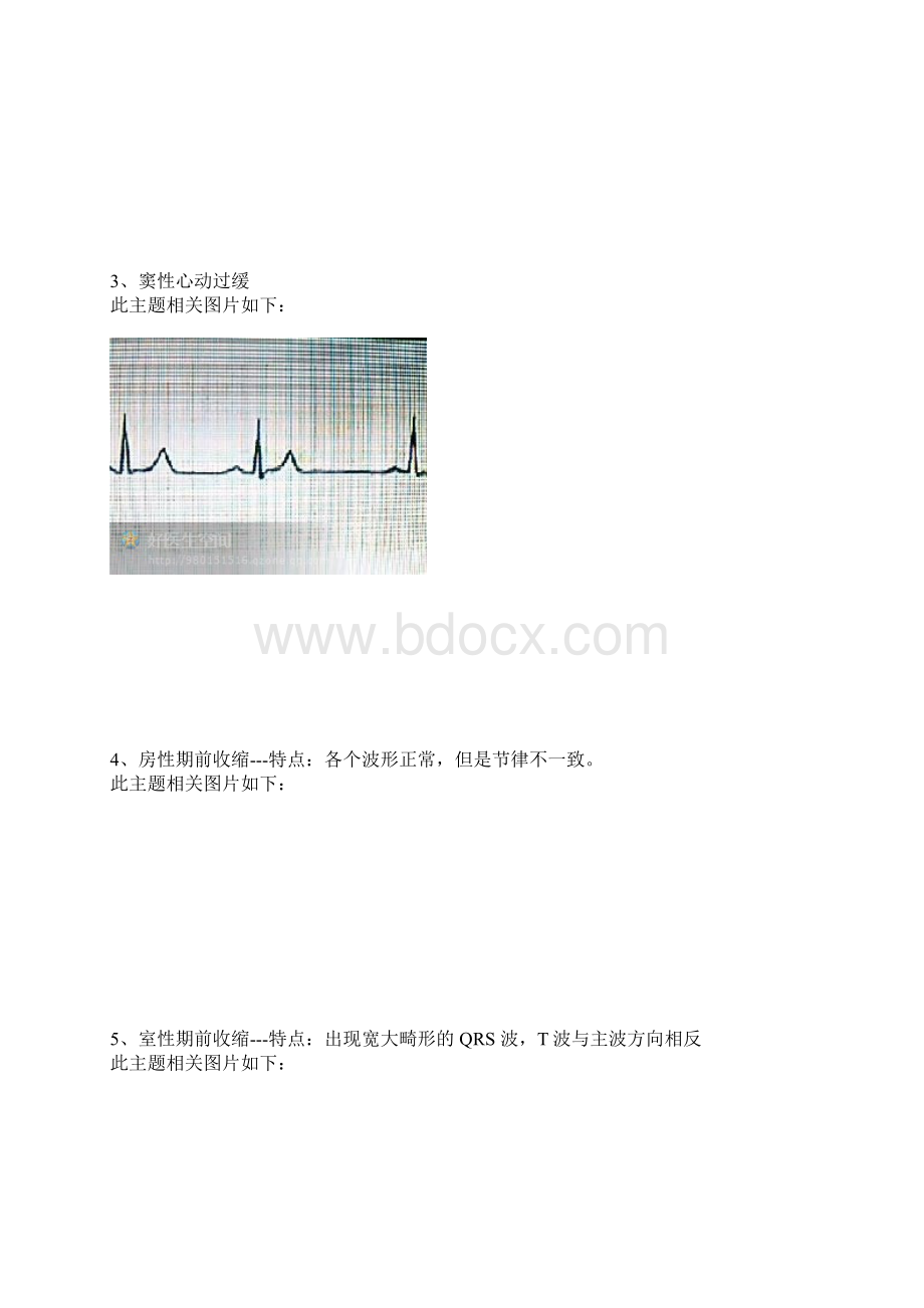 心电图的记忆方法收藏着.docx_第3页