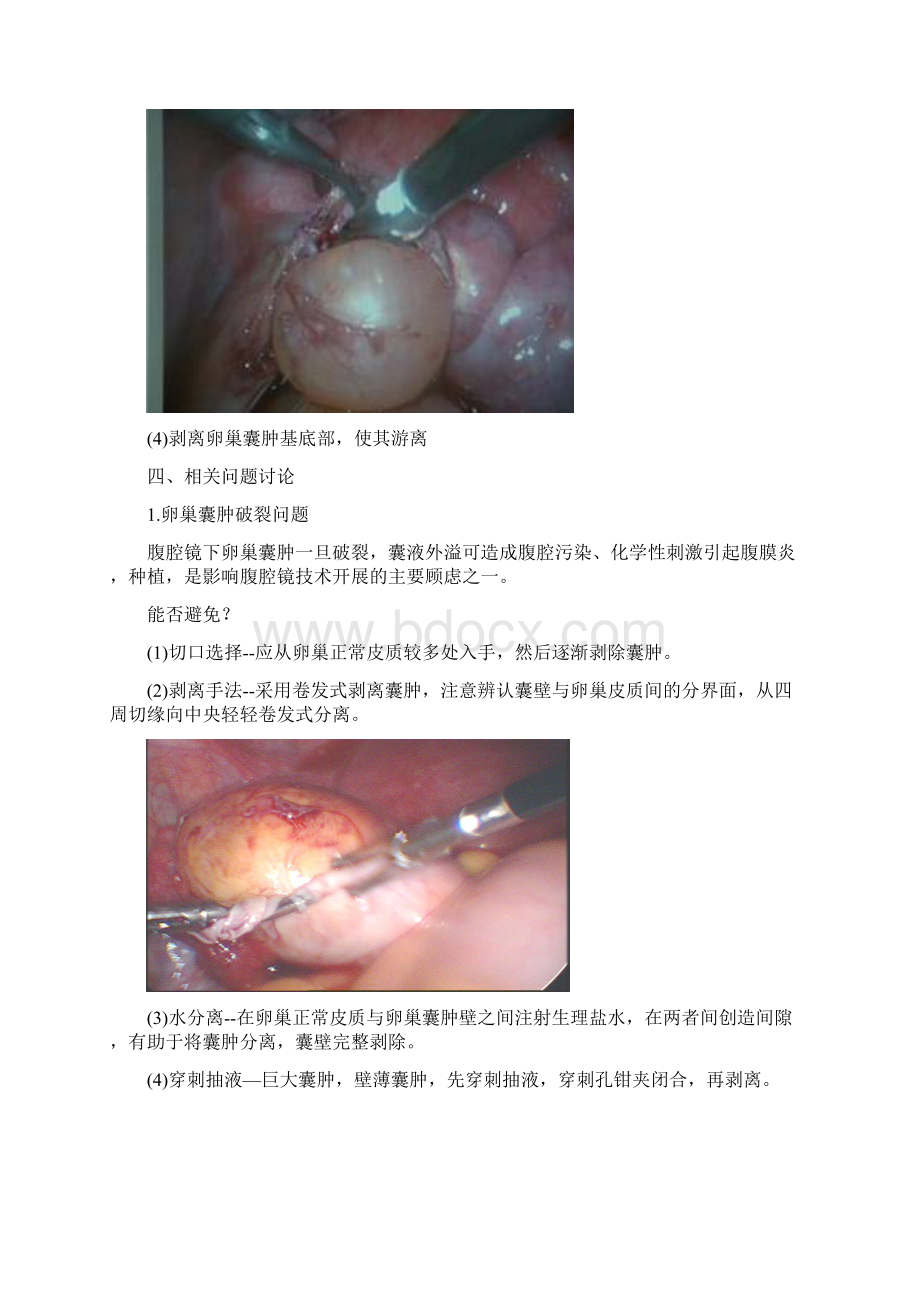 整理腹腔镜下卵巢囊肿剥除术Word文档下载推荐.docx_第3页