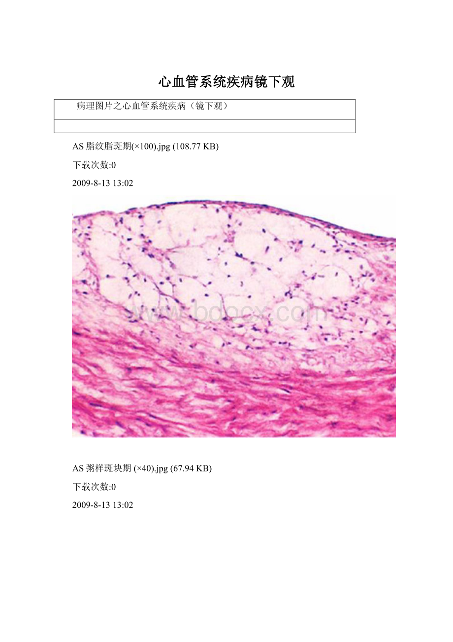 心血管系统疾病镜下观Word格式文档下载.docx