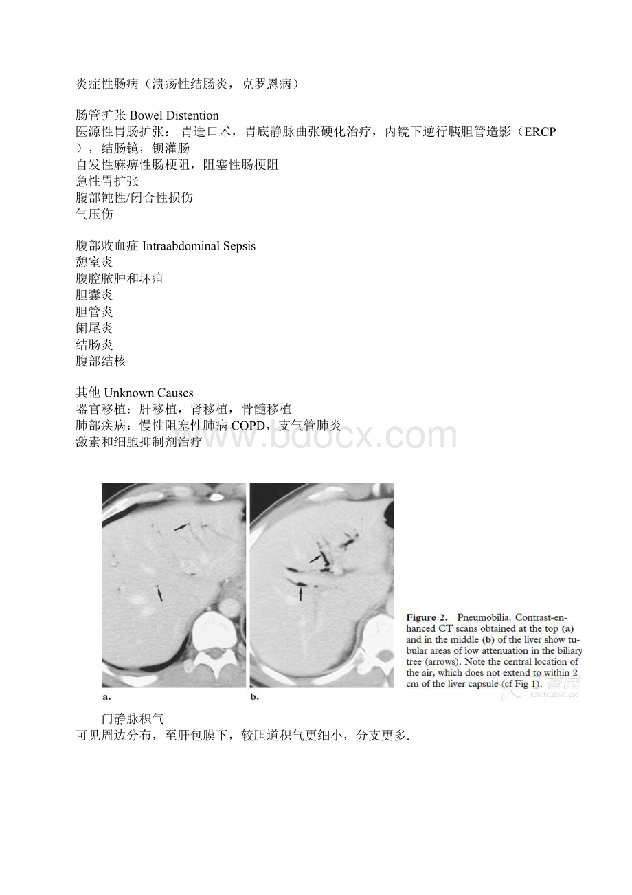 门脉系统积气丁香园.docx_第2页