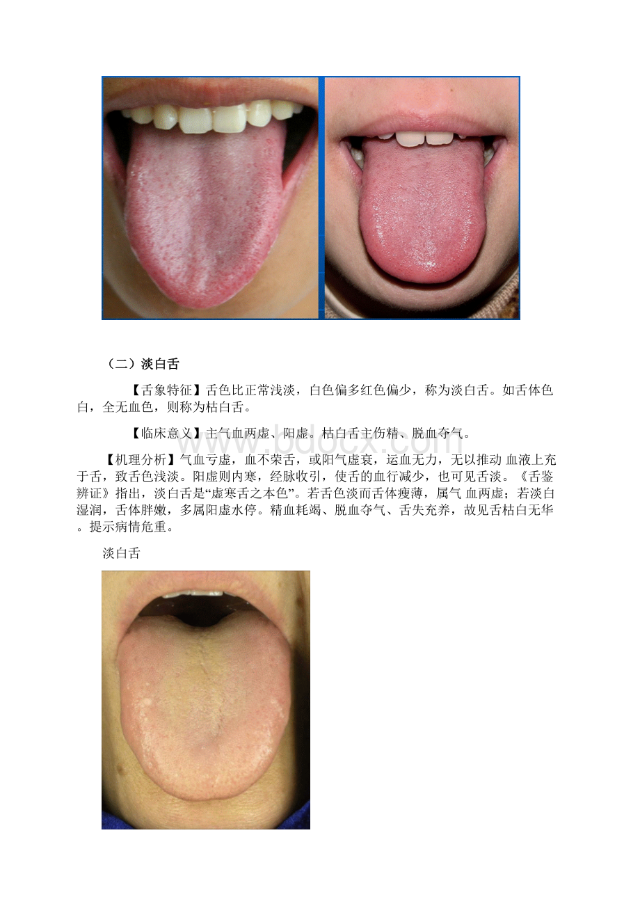 《舌诊及舌下脉络图解》.docx_第3页