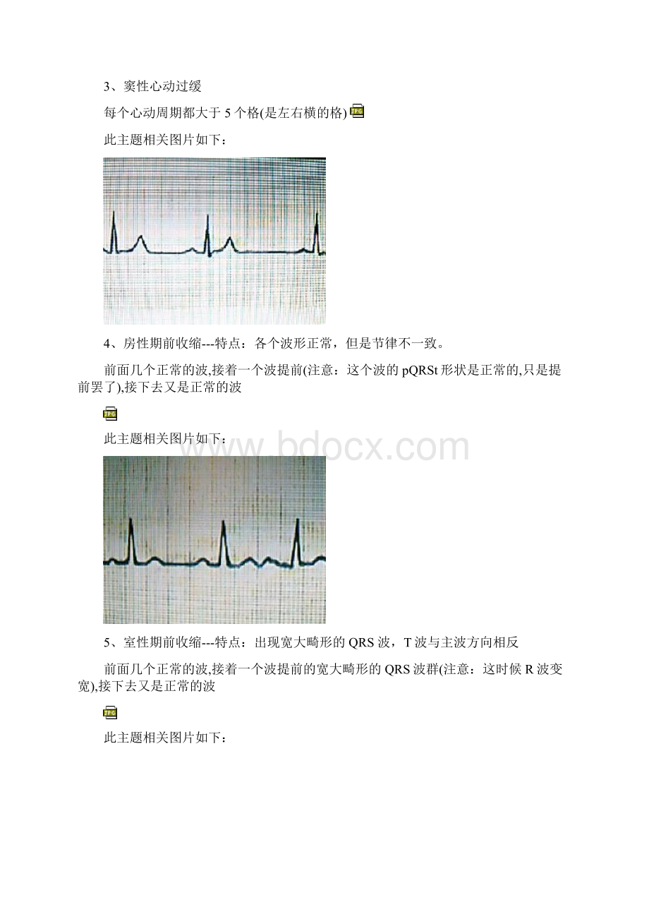 手把手教你读心电图图解.docx_第3页