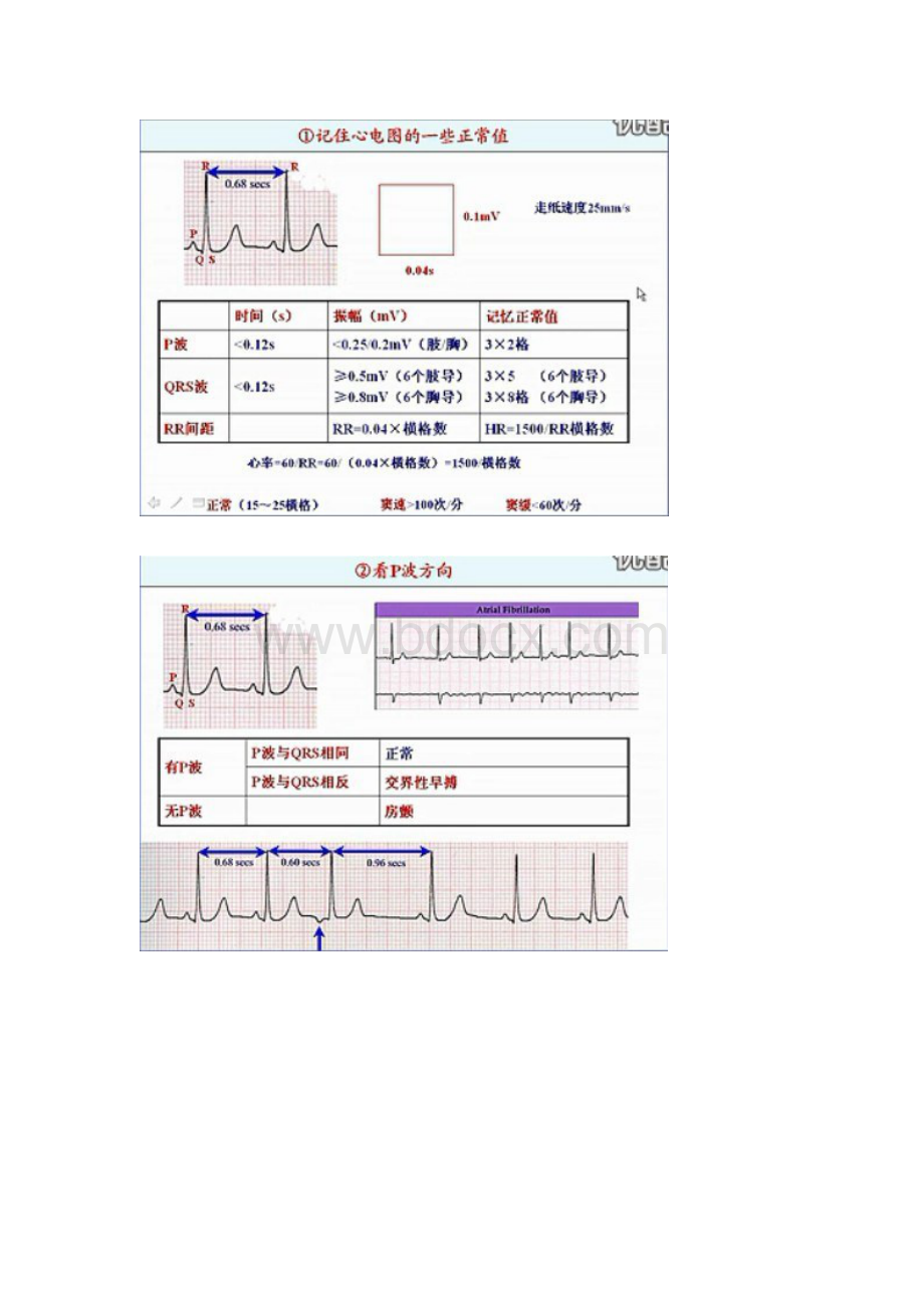 心电图总结文档格式.doc_第2页