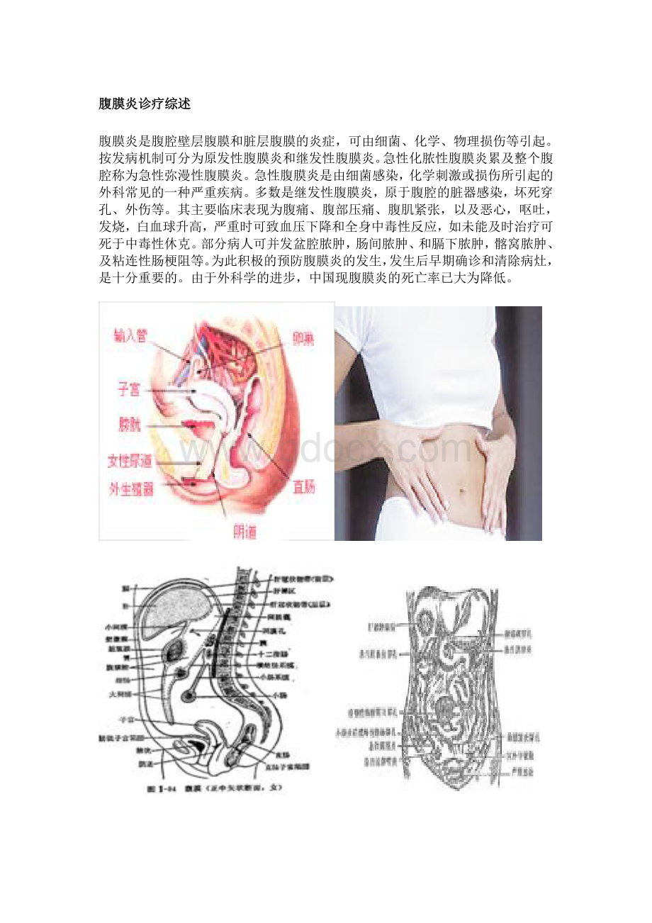 腹膜炎诊疗综述.doc