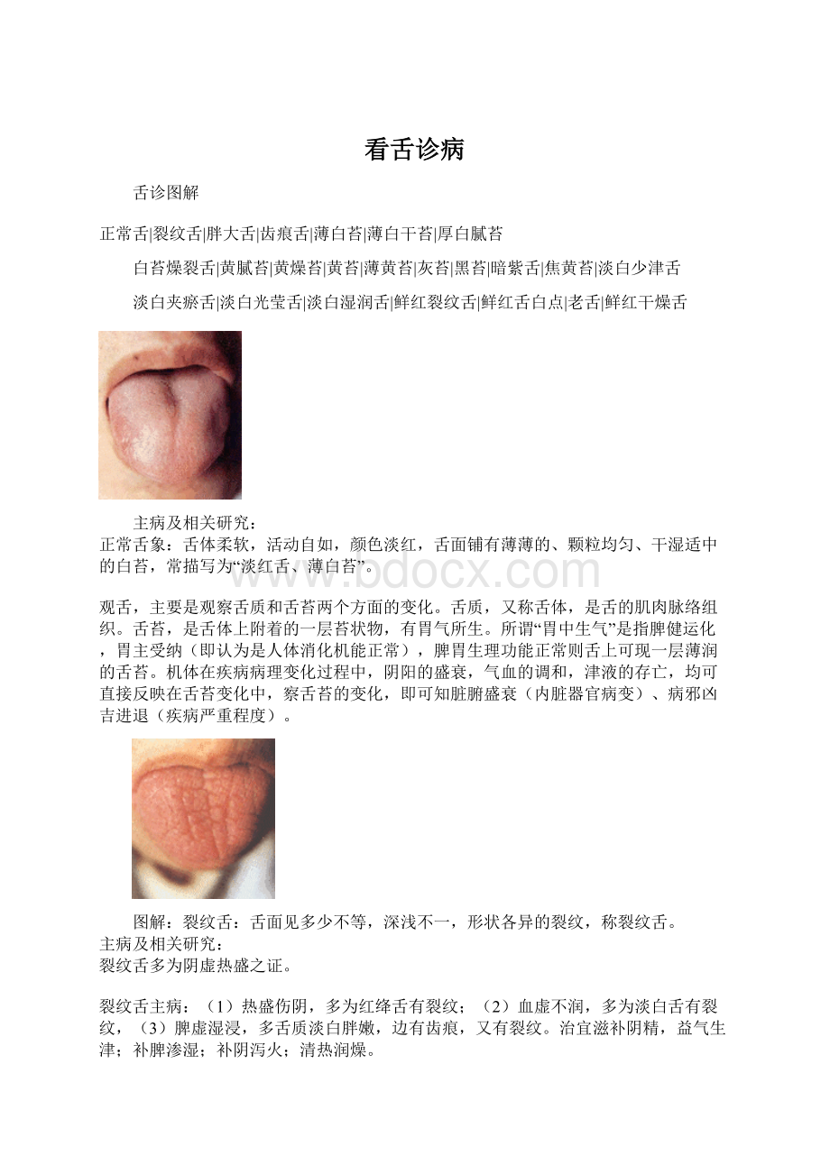 看舌诊病文档格式.docx