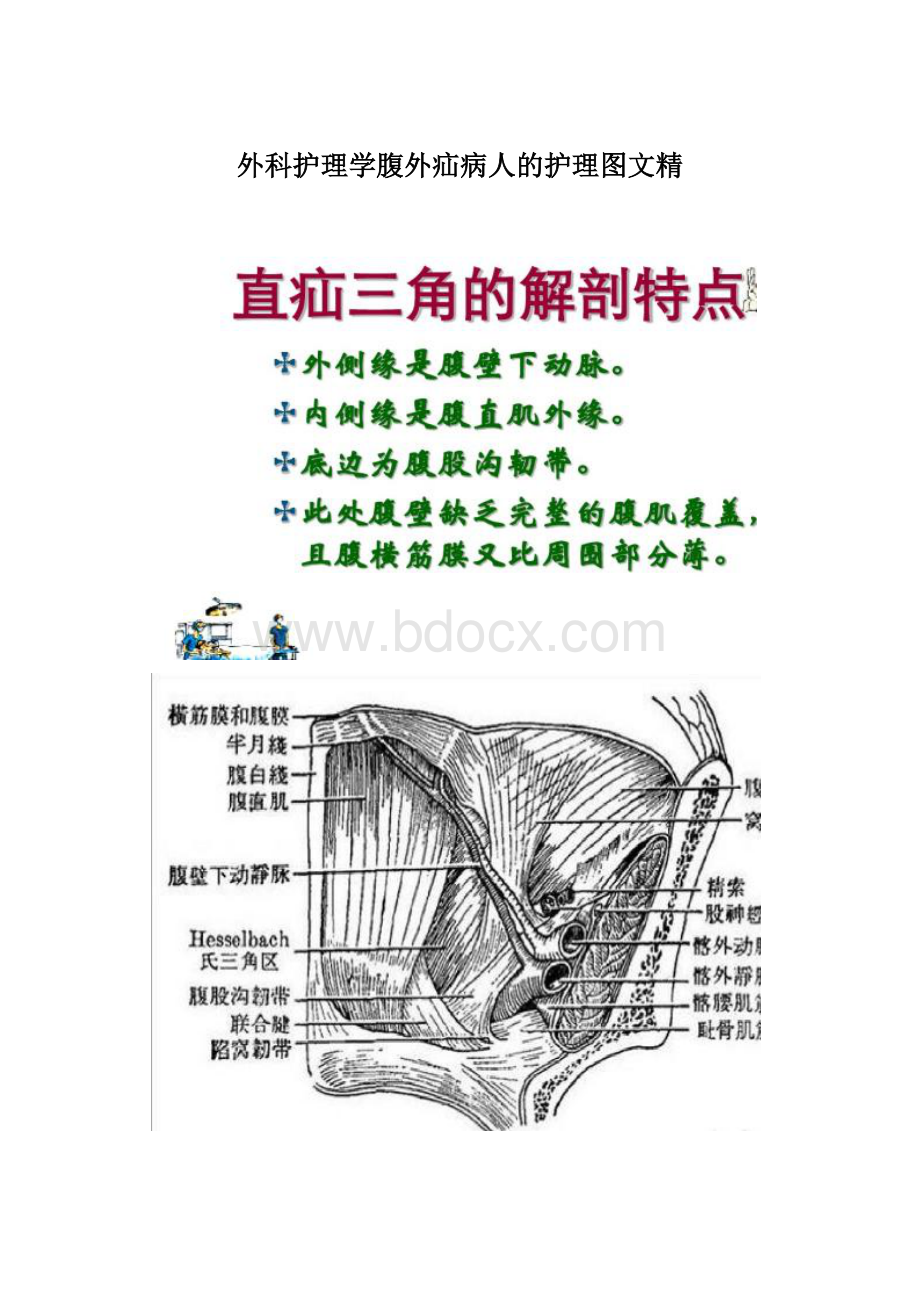 外科护理学腹外疝病人的护理图文精Word文件下载.docx_第1页