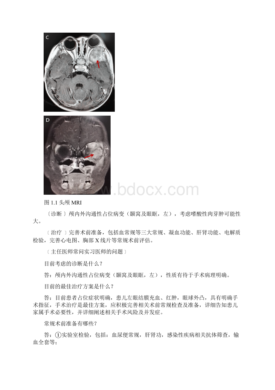 嗜酸性肉芽肿Word格式文档下载.docx_第3页