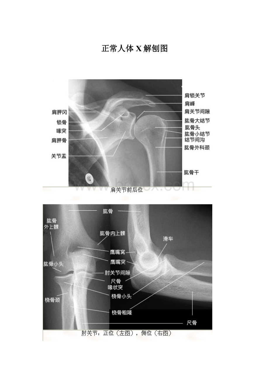 正常人体X解刨图.docx