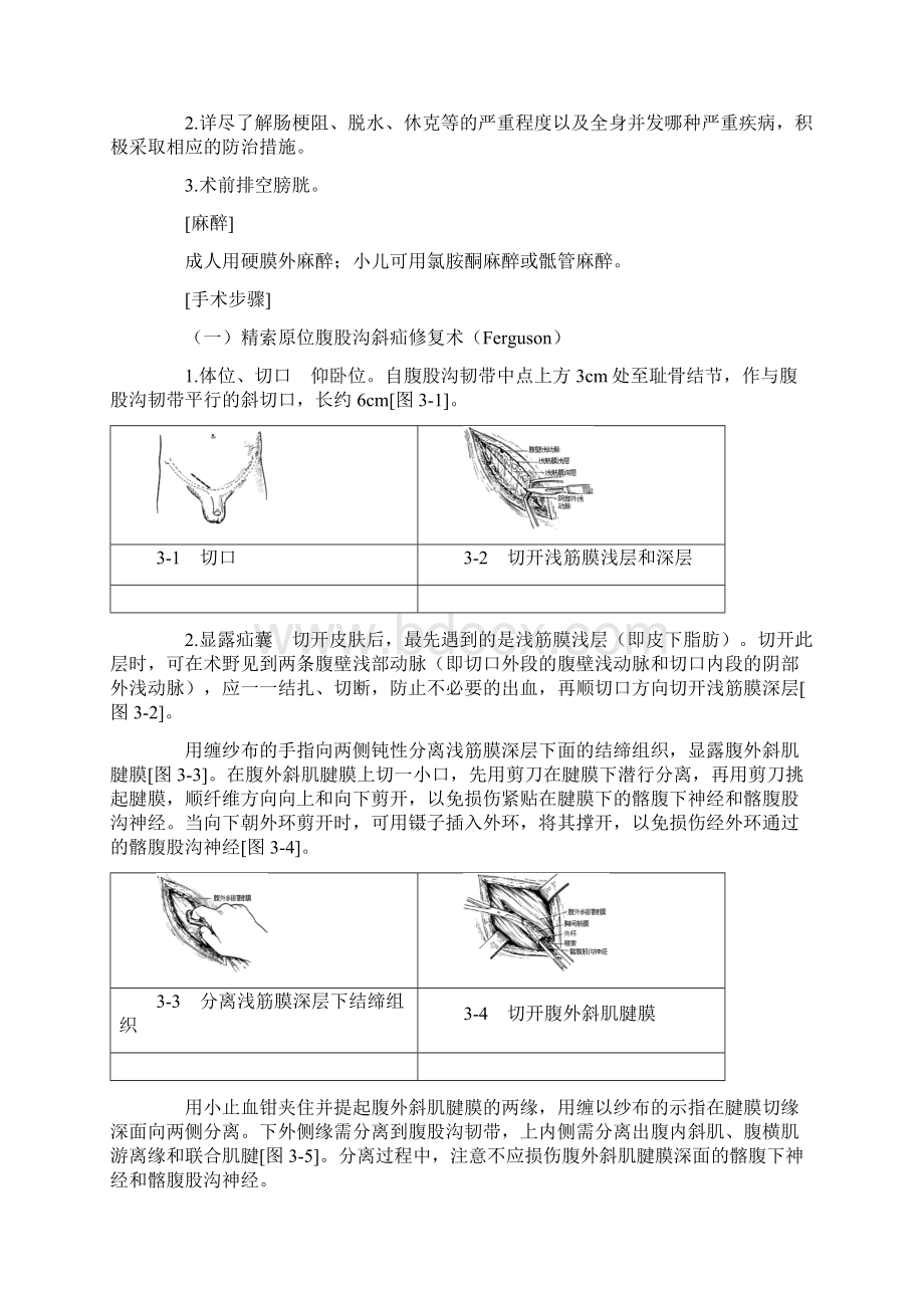 一般腹股沟斜疝修复术手术图谱之欧阳生创编文档格式.docx_第3页