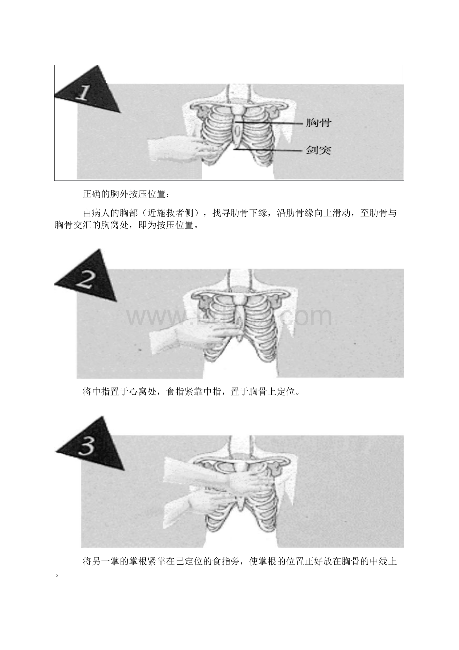 紧急医疗救护常识.docx_第3页