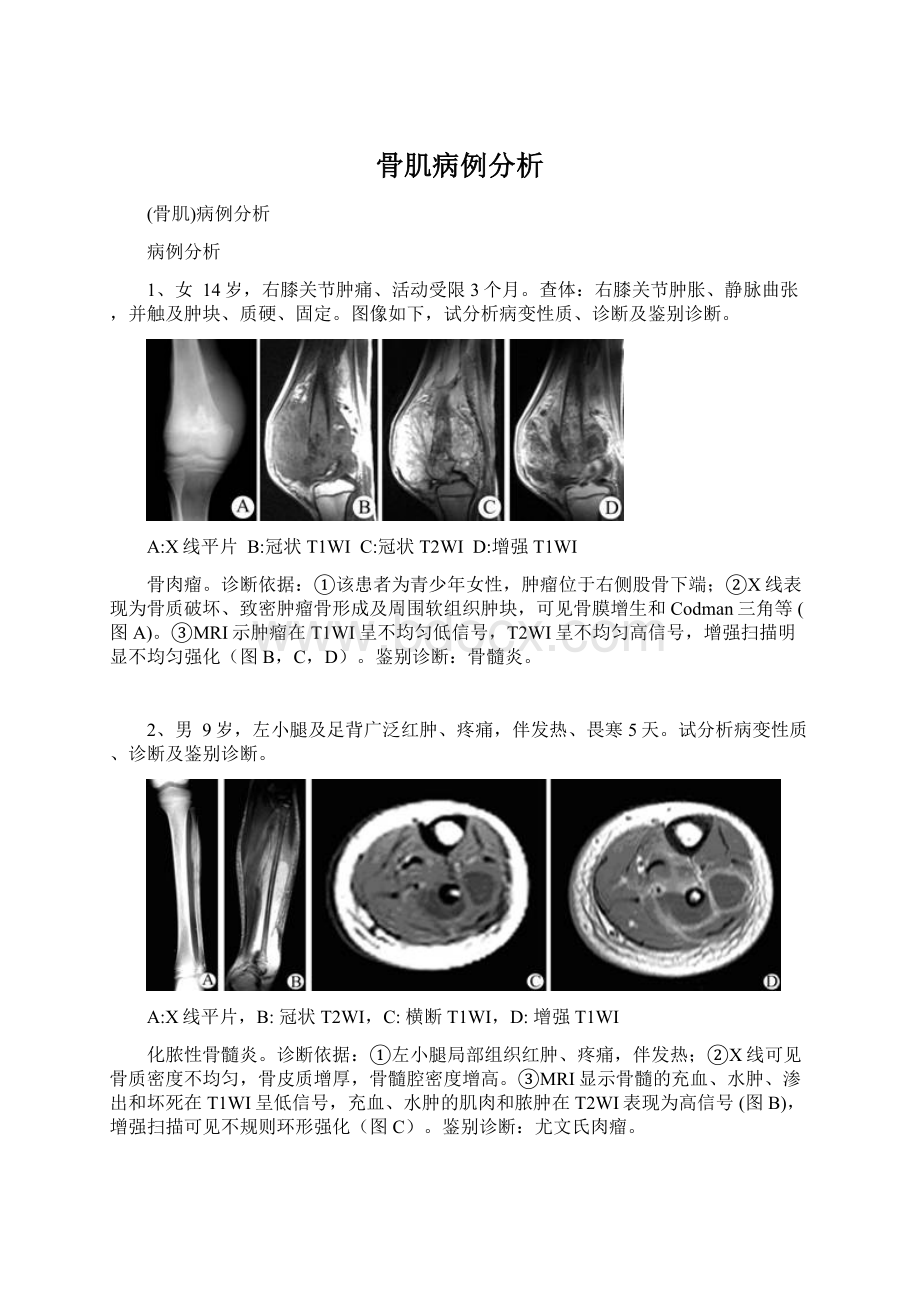 骨肌病例分析Word下载.docx