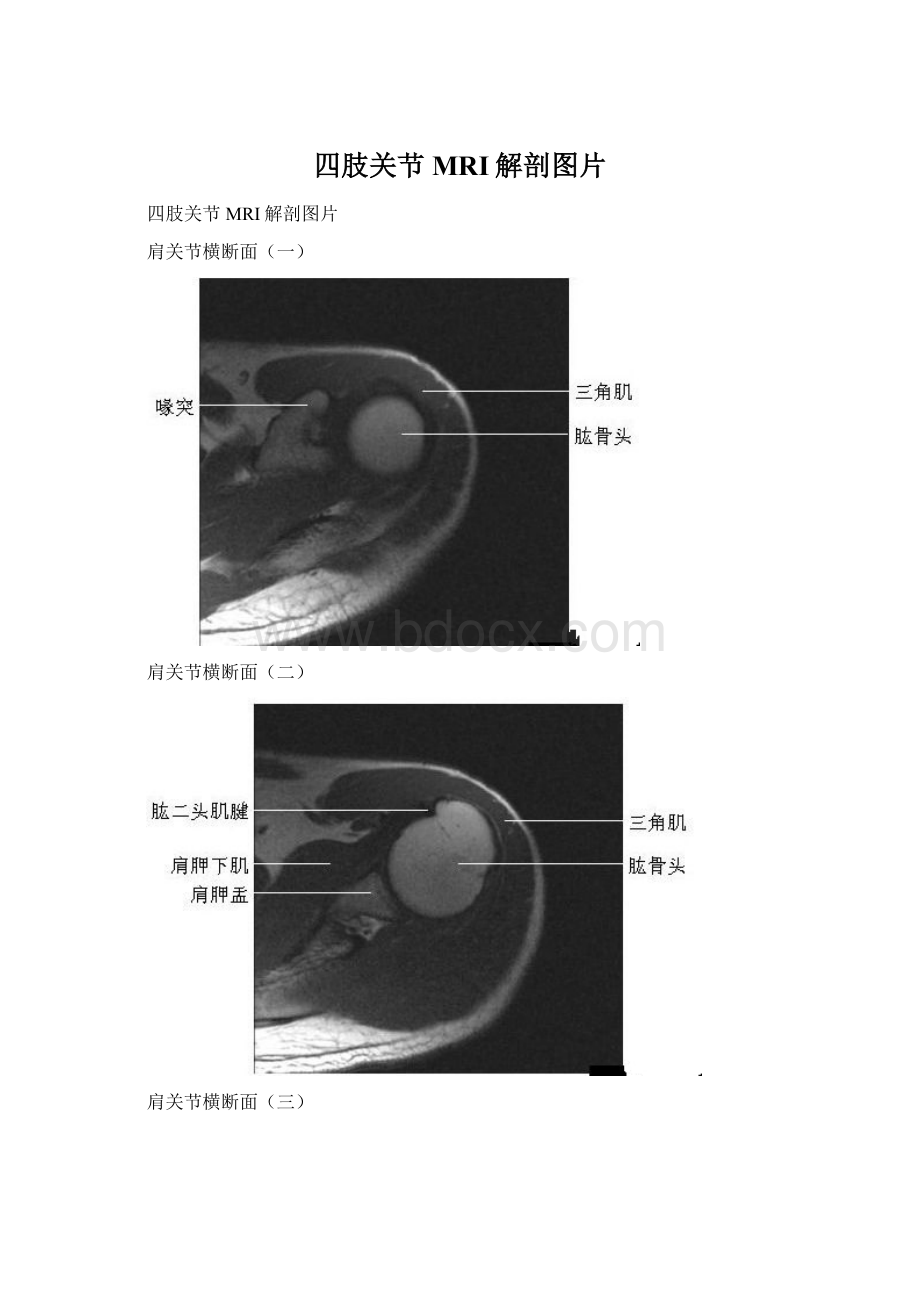 四肢关节MRI解剖图片.docx