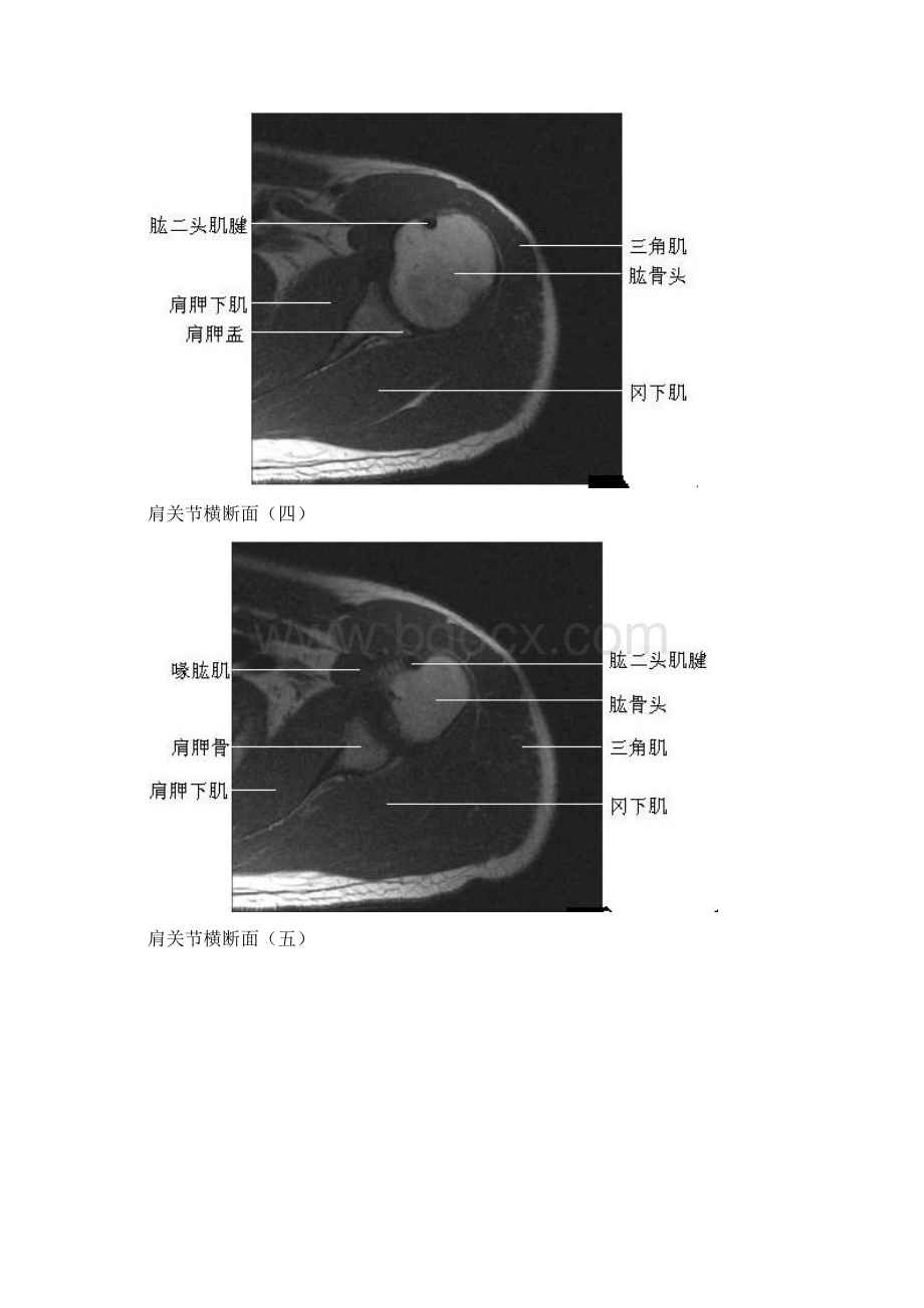 四肢关节MRI解剖图片Word文档下载推荐.docx_第2页