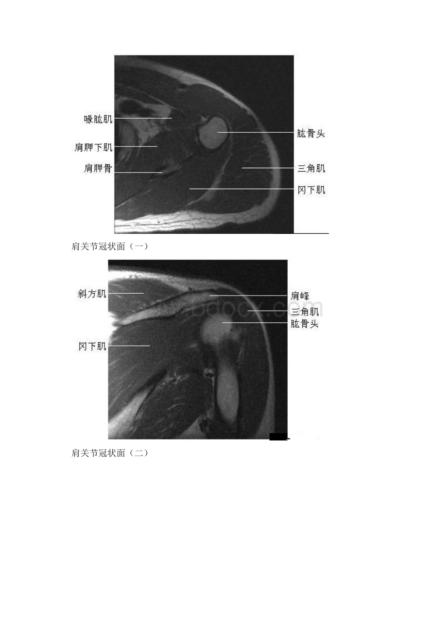 四肢关节MRI解剖图片Word文档下载推荐.docx_第3页