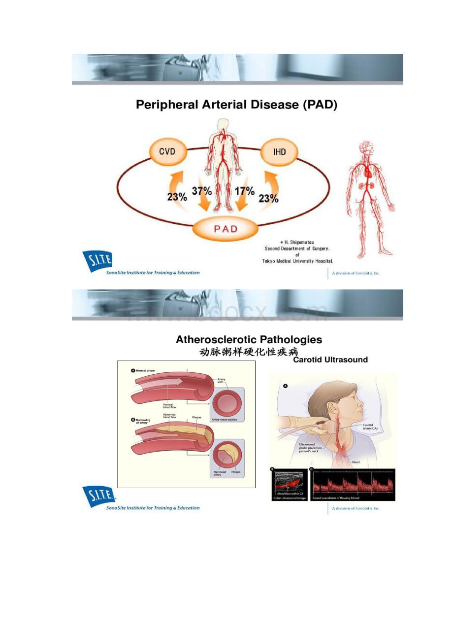 便携彩超在血管外科的临床.docx_第2页