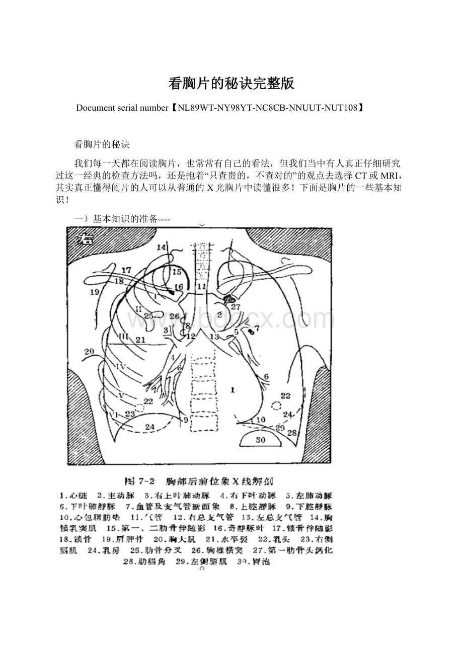 看胸片的秘诀完整版Word格式.docx_第1页