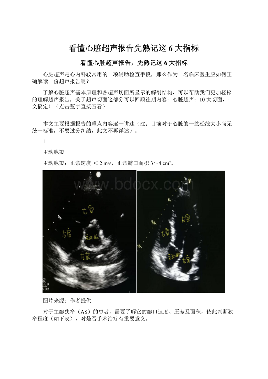 看懂心脏超声报告先熟记这 6 大指标Word文件下载.docx