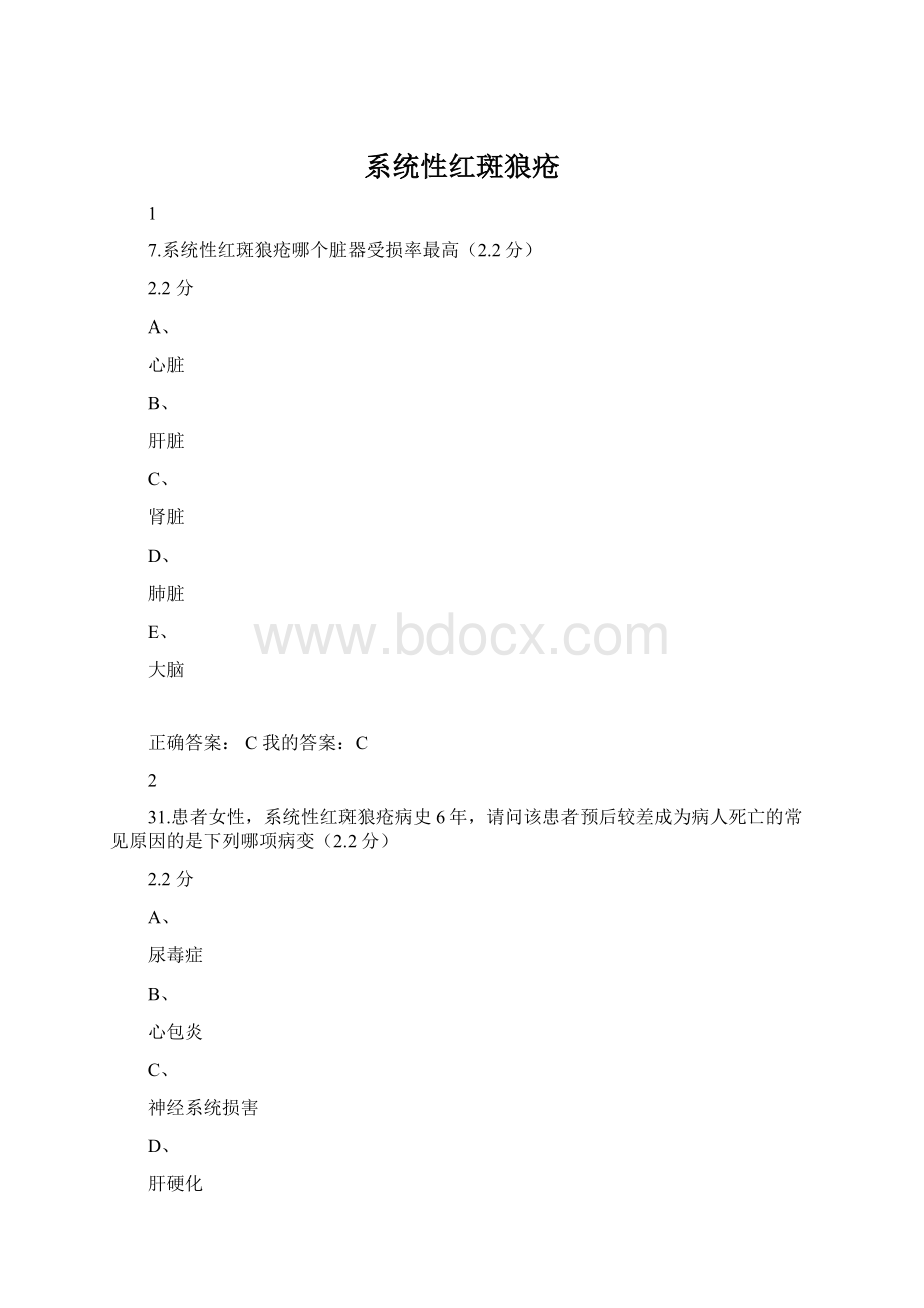 系统性红斑狼疮.docx