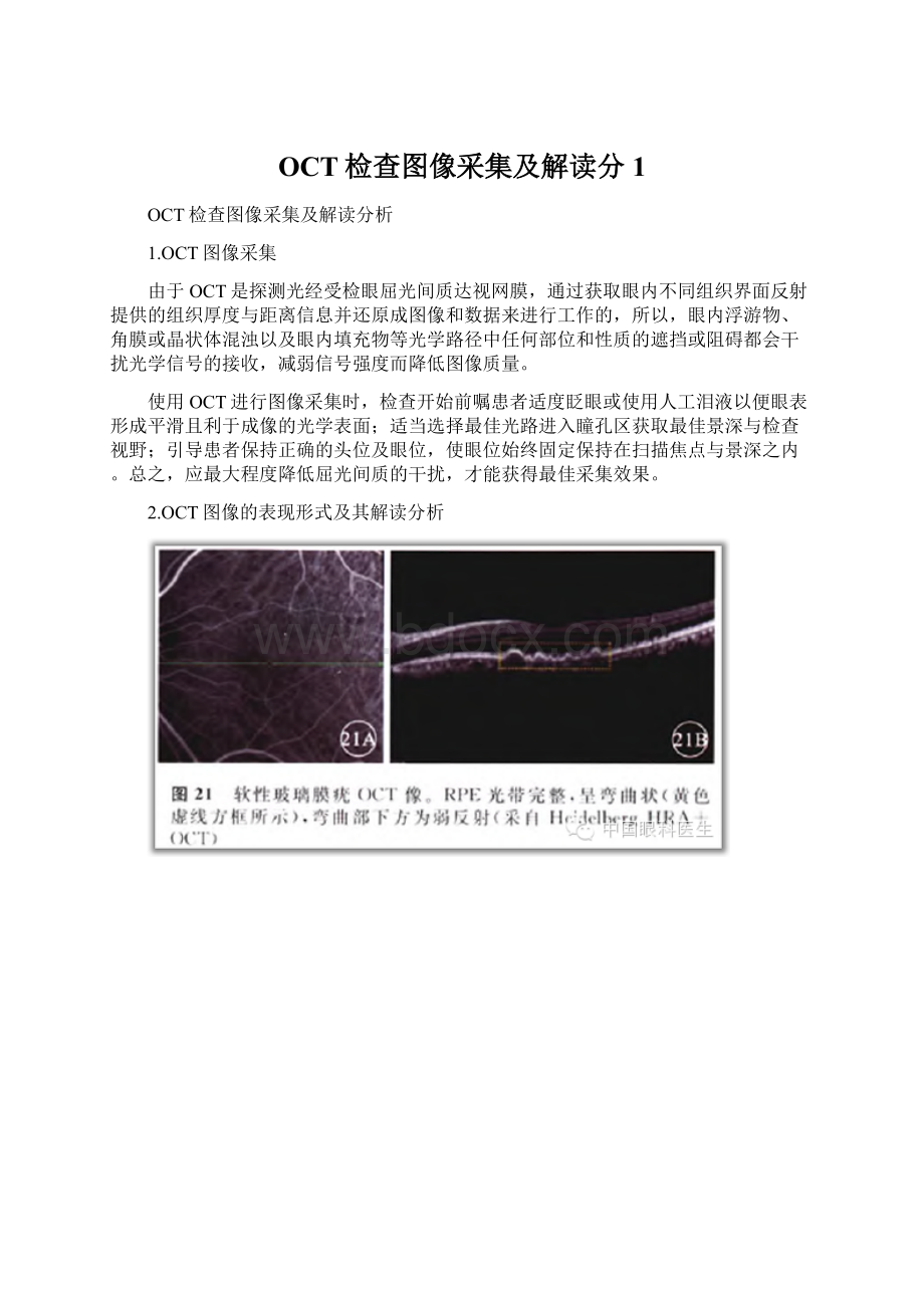 OCT检查图像采集及解读分1Word格式.docx_第1页