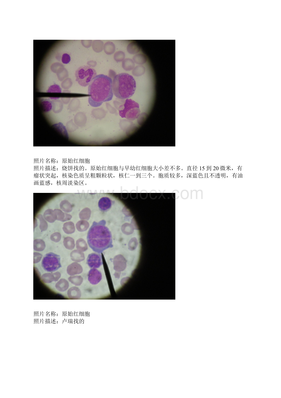 血液学髓片细胞形态.docx_第2页