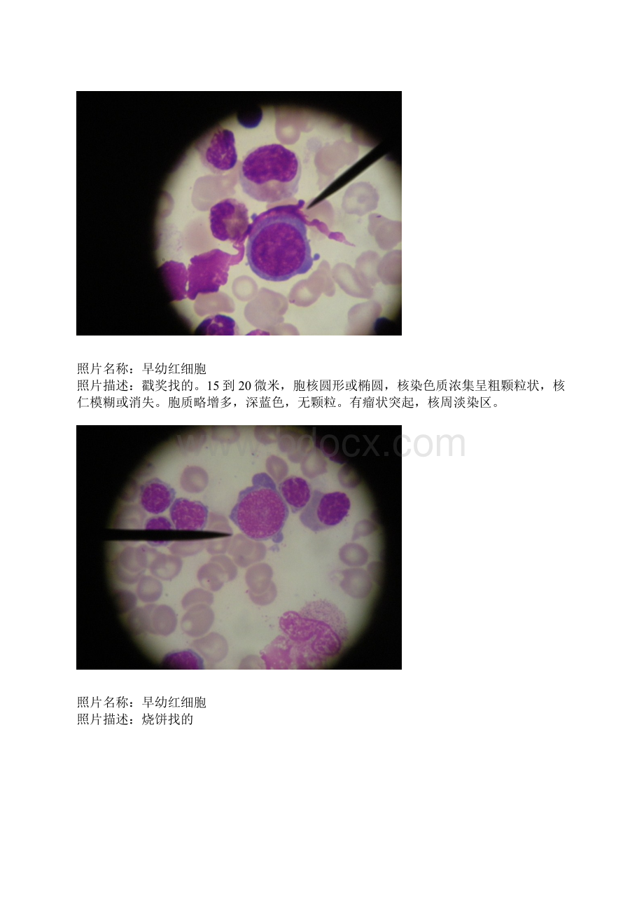 血液学髓片细胞形态.docx_第3页