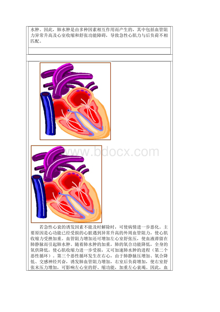 心衰患者围麻醉期管理.docx_第3页