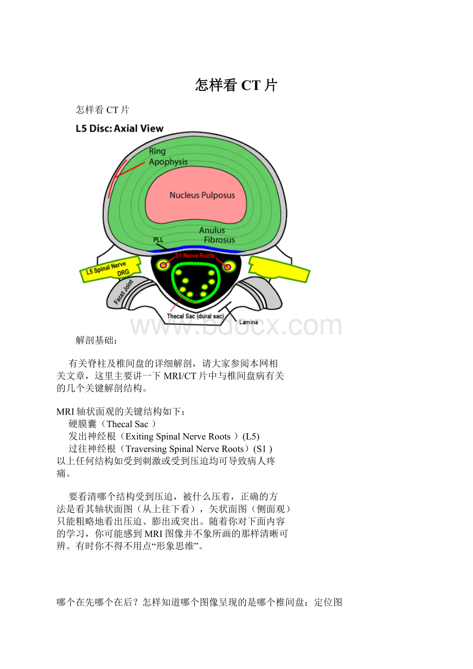 怎样看CT片Word文件下载.docx