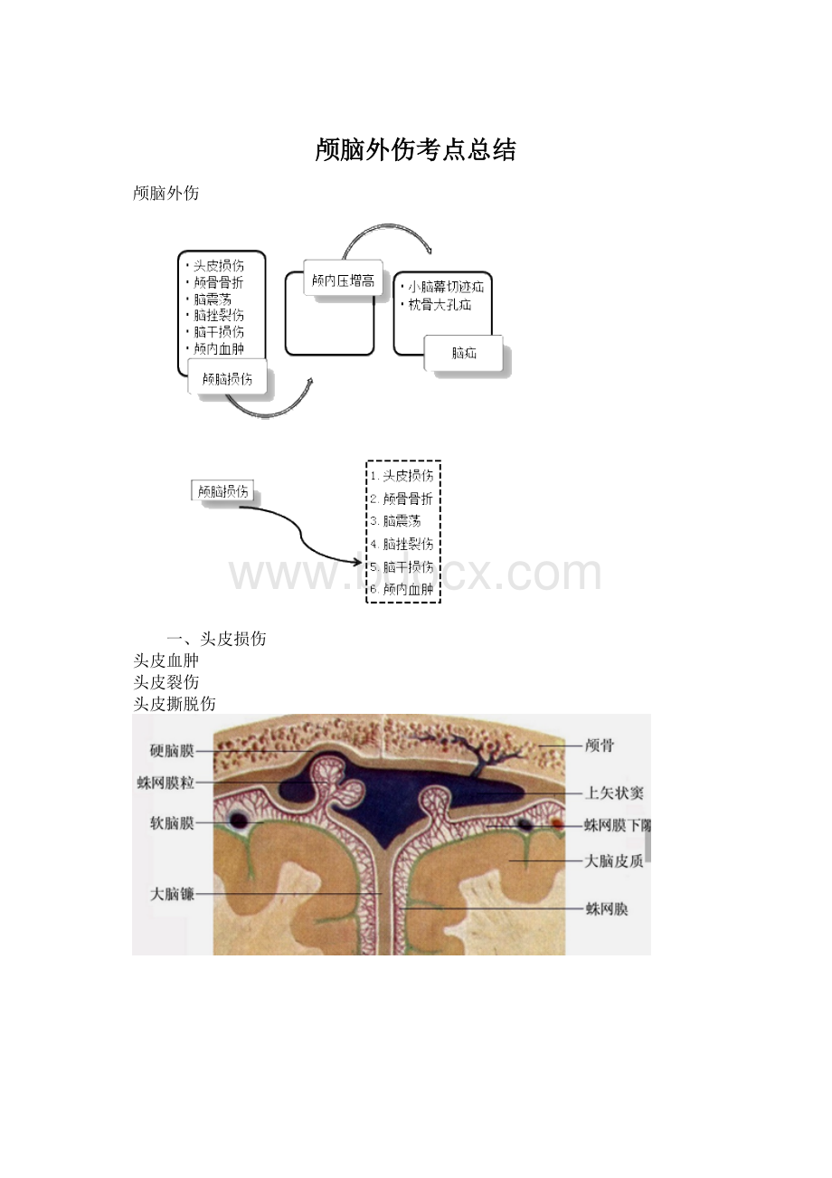 颅脑外伤考点总结文档格式.docx_第1页