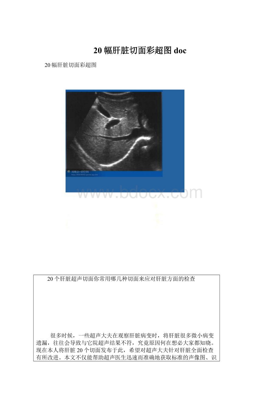 20幅肝脏切面彩超图doc.docx