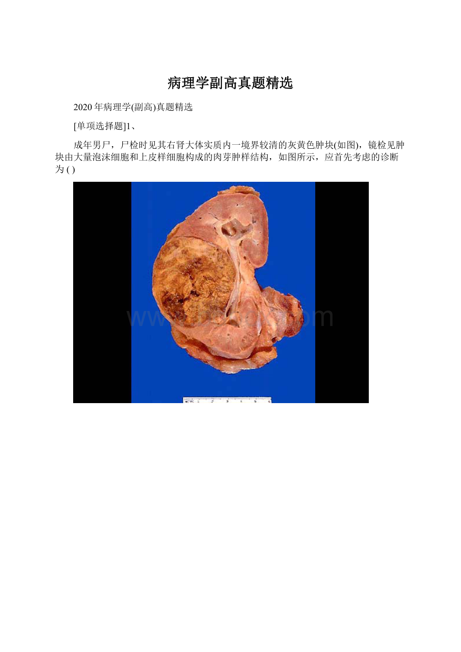 病理学副高真题精选.docx_第1页