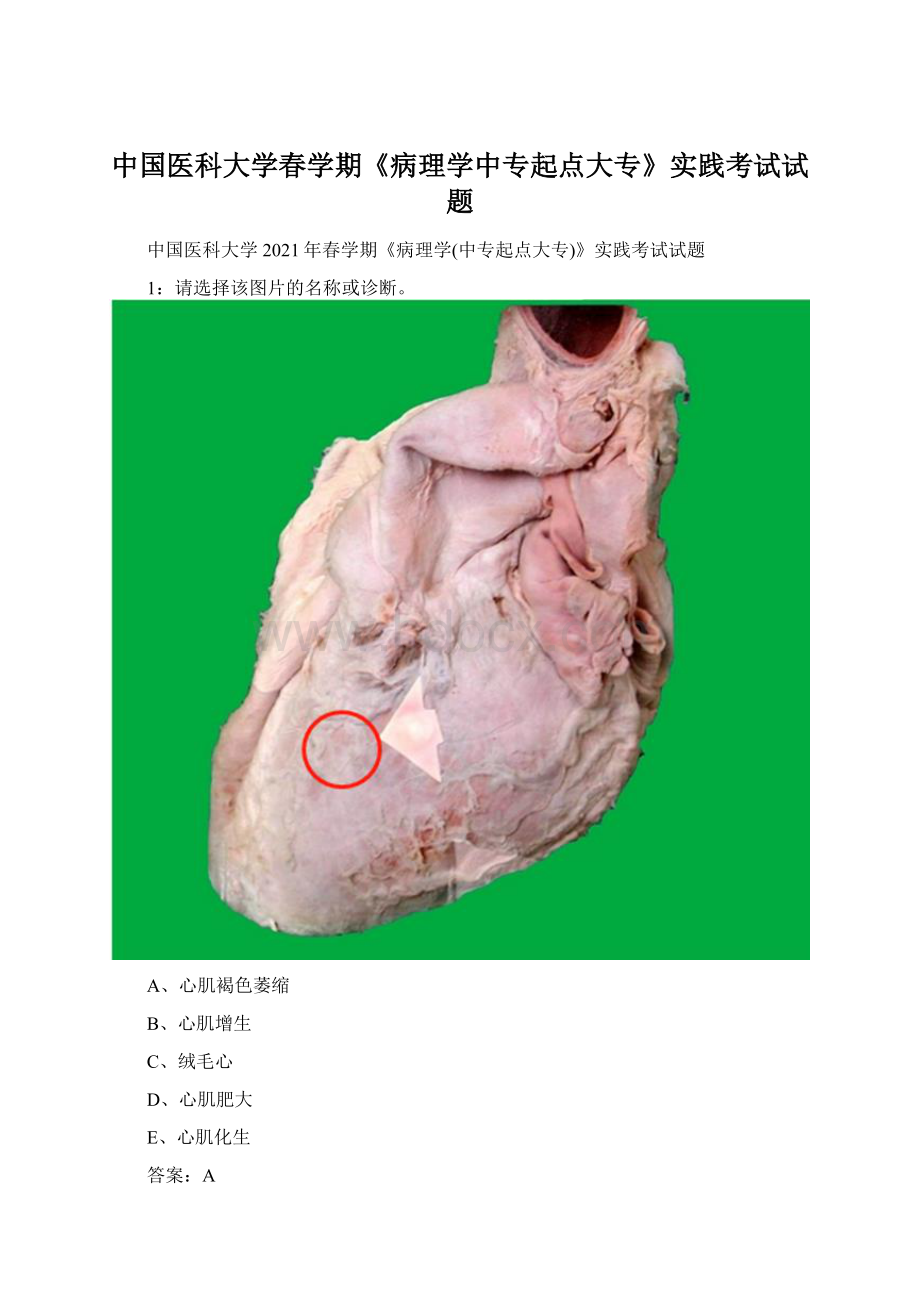 中国医科大学春学期《病理学中专起点大专》实践考试试题.docx