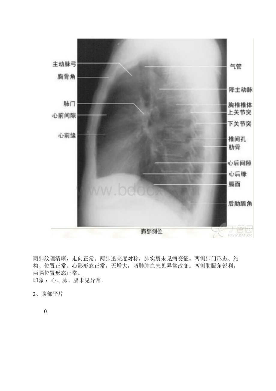 执业医师影像读片.docx_第3页